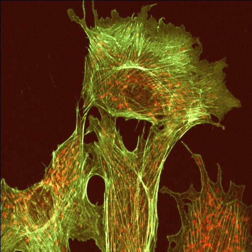 Confocal Microscopy Example