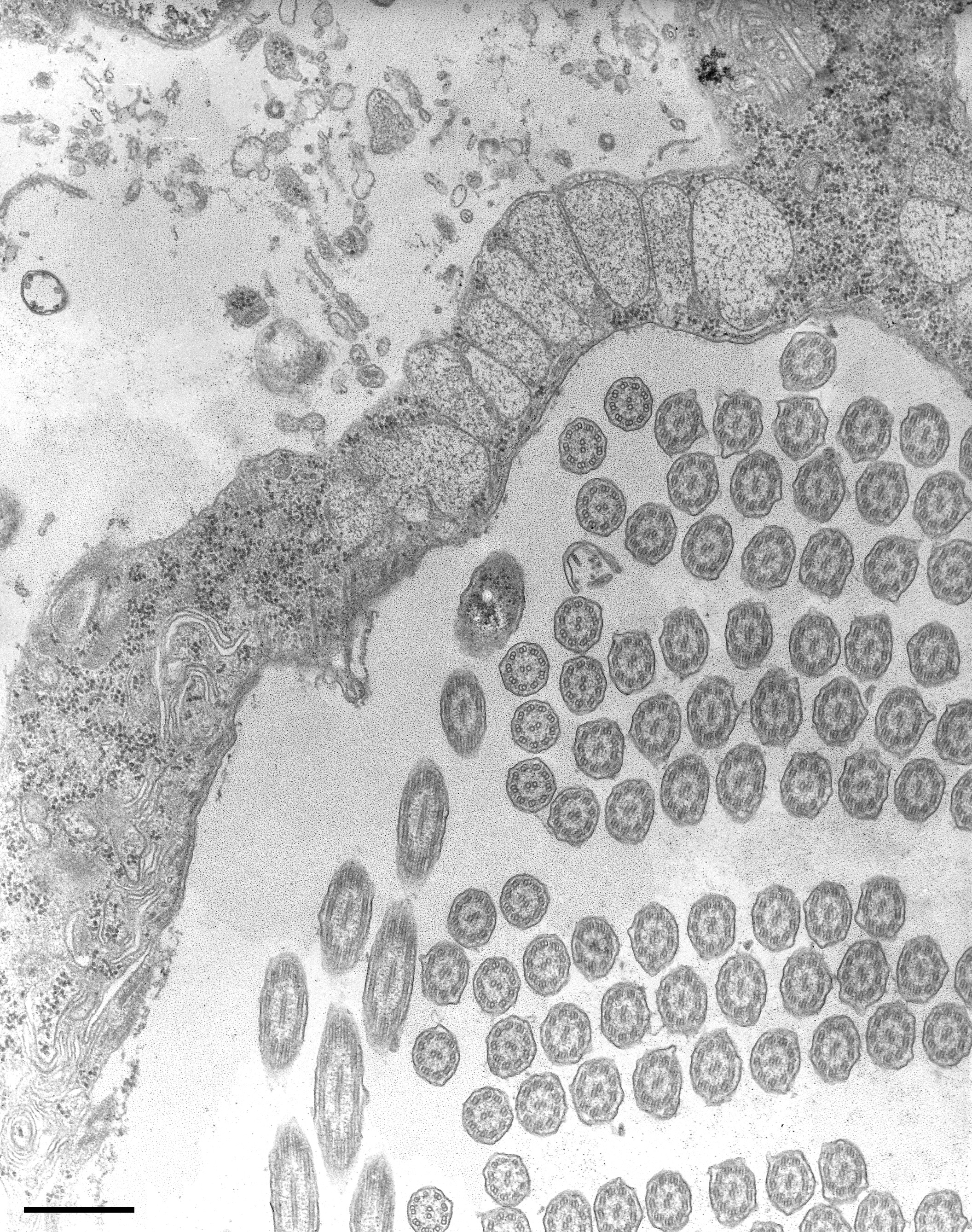 Electron Microscopy Example